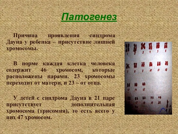 Патогенез Причина проявления синдрома Дауна у ребенка – присутствие лишней хромосомы.