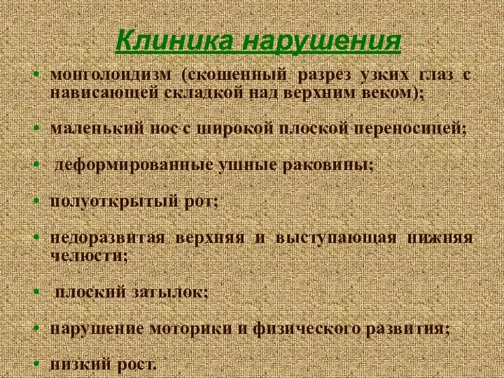 Клиника нарушения монголоидизм (скошенный разрез узких глаз с нависающей складкой над