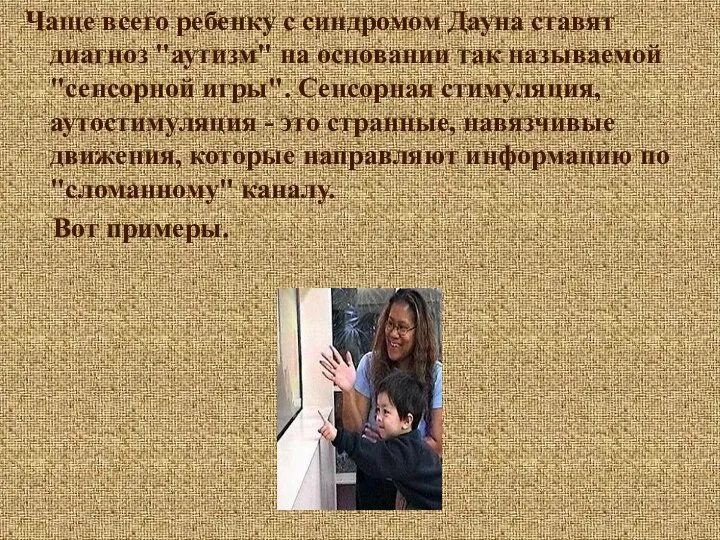 Чаще всего ребенку с синдромом Дауна ставят диагноз "аутизм" на основании