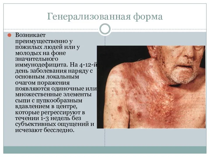 Генерализованная форма Возникает преимущественно у пожилых людей или у молодых на