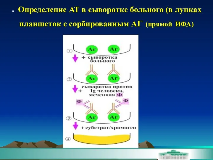 . Определение АТ в сыворотке больного (в лунках планшеток с сорбированным АГ (прямой ИФА)