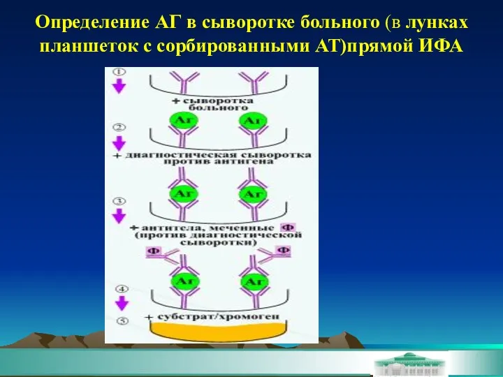 Определение АГ в сыворотке больного (в лунках планшеток с сорбированными АТ)прямой ИФА