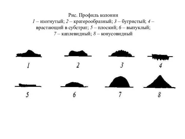 Рис. Профиль колонии 1 – изогнутый; 2 – кратерообразный; 3 –