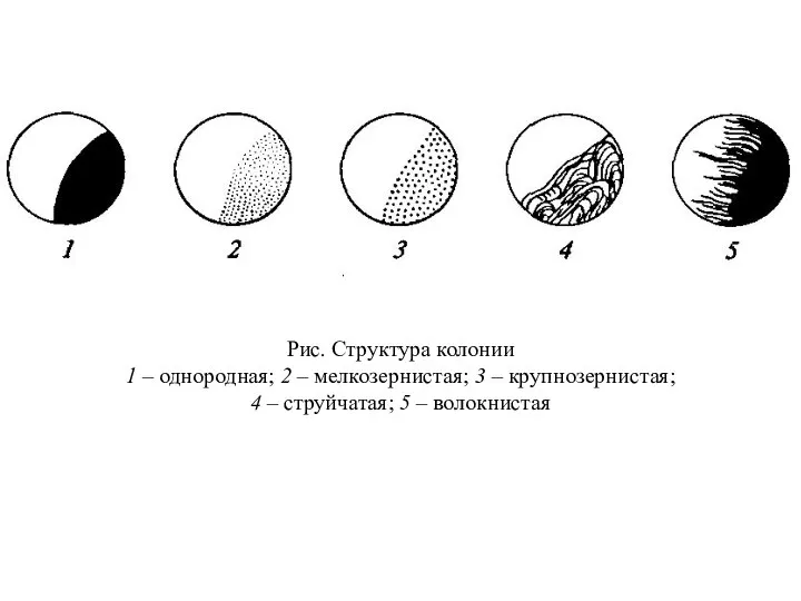 Рис. Структура колонии 1 – однородная; 2 – мелкозернистая; 3 –