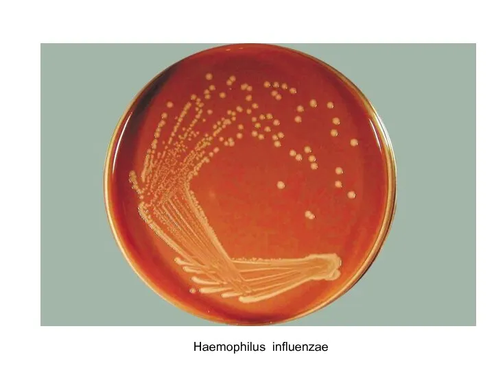 Haemophilus influenzae