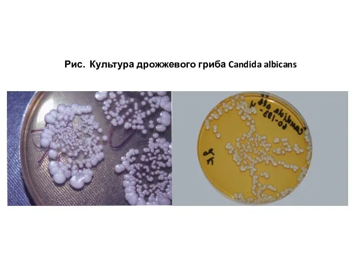 Рис. Культура дрожжевого гриба Candida albicans
