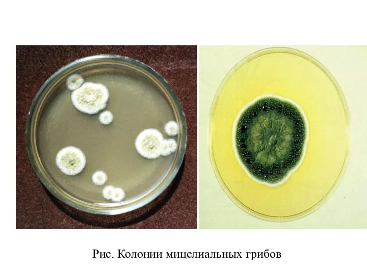 Рис. Колонии мицелиальных грибов