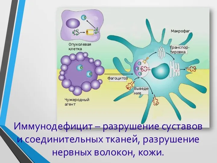 Иммунодефицит – разрушение суставов и соединительных тканей, разрушение нервных волокон, кожи.