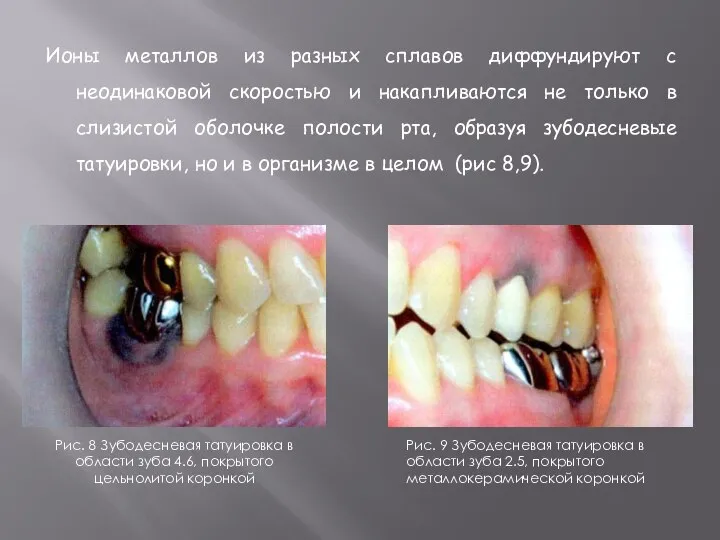 Ионы металлов из разных сплавов диффундируют с неодинаковой скоростью и накапливаются