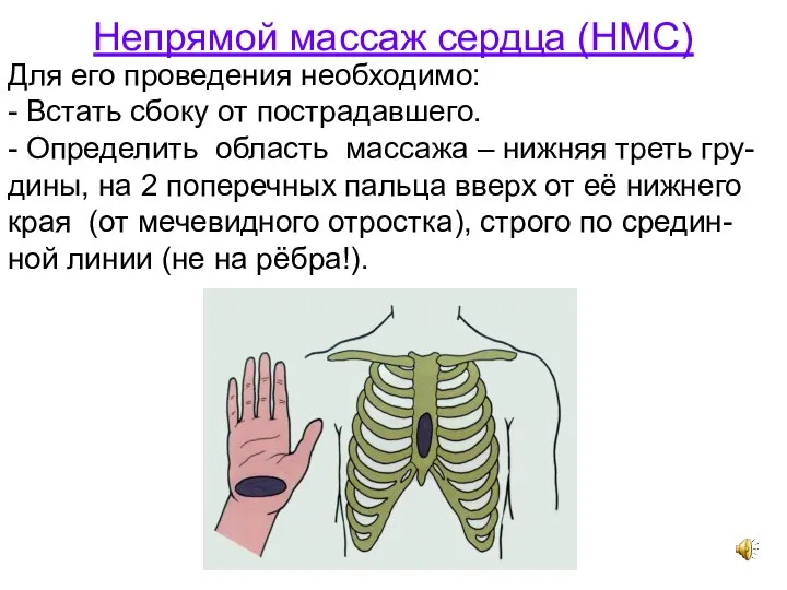 Непрямой массаж сердца (НМС) Для его проведения необходимо: - Встать сбоку