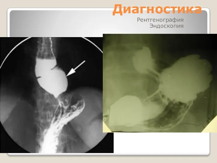 Диагностика Рентгенография Эндоскопия