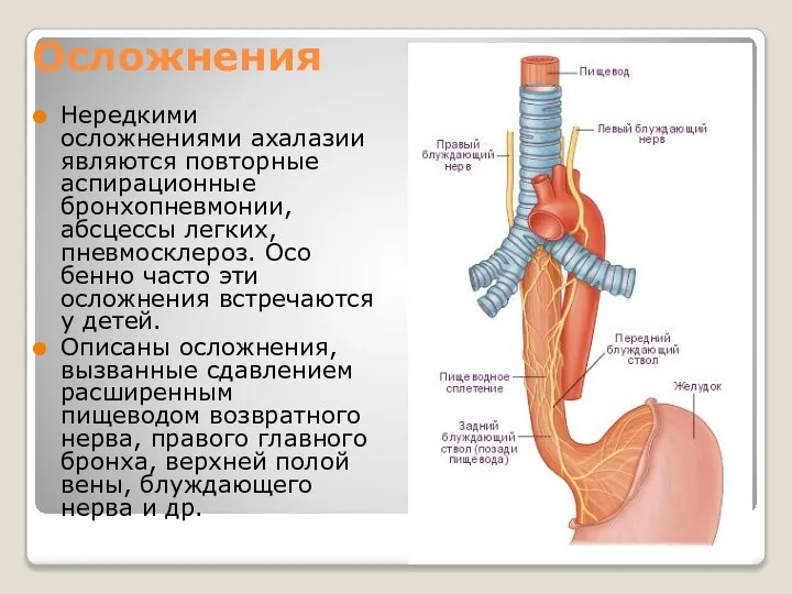 Осложнения Нередкими осложнениями ахалазии являются повторные аспирационные бронхопневмонии, абсцессы легких, пневмосклероз.