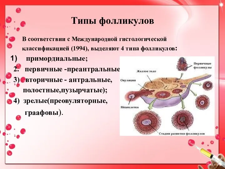 Типы фолликулов В соответствии с Международной гистологической классификацией (1994), выделяют 4