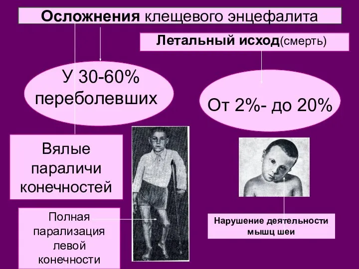 Осложнения клещевого энцефалита У 30-60% переболевших От 2%- до 20% Летальный