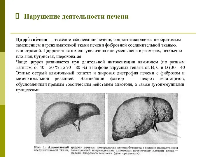 Нарушение деятельности печени Цирро́з пе́чени — тяжёлое заболевание печени, сопровождающееся необратимым