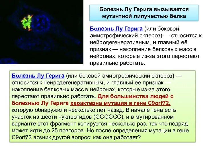 Болезнь Лу Герига (или боковой амиотрофический склероз) — относится к нейродегенеративным,