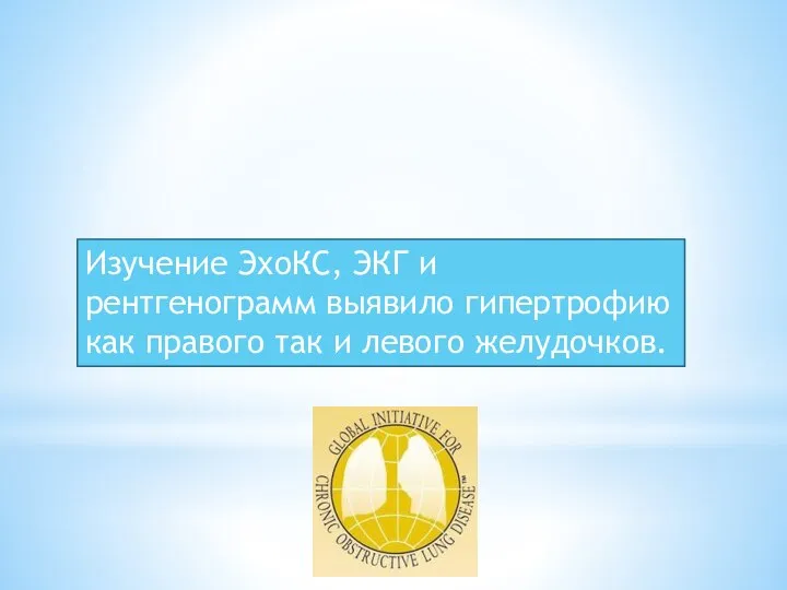 Изучение ЭхоКС, ЭКГ и рентгенограмм выявило гипертрофию как правого так и левого желудочков.