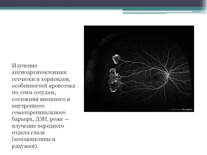 ЦЕЛЬ Изучение ангиоархитектоники сетчатки и хориоидеи, особенностей кровотока по этим сосудам,