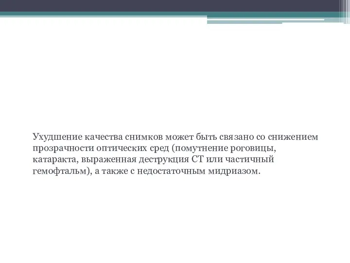 Факторы, влияющие на результат Ухудшение качества снимков может быть связано со