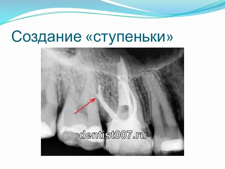 Создание «ступеньки»