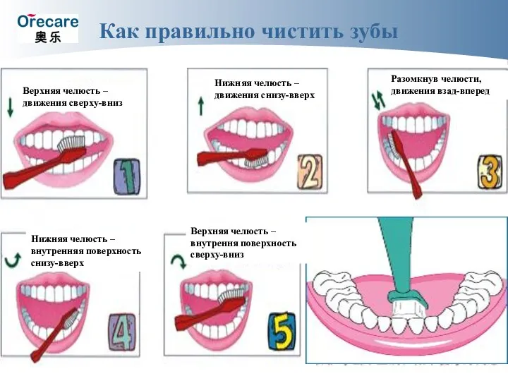 Как правильно чистить зубы Верхняя челюсть – движения сверху-вниз Нижняя челюсть