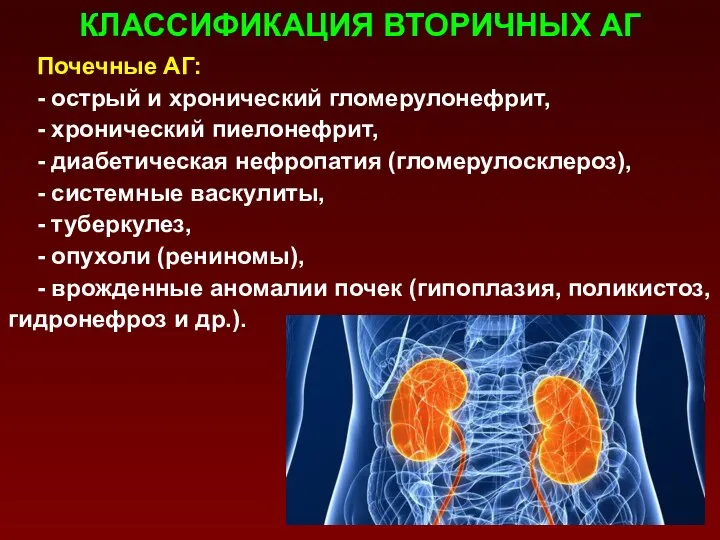 КЛАССИФИКАЦИЯ ВТОРИЧНЫХ АГ Почечные АГ: - острый и хронический гломерулонефрит, -