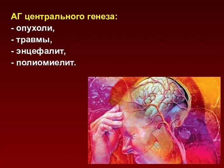 АГ центрального генеза: - опухоли, - травмы, - энцефалит, - полиомиелит.