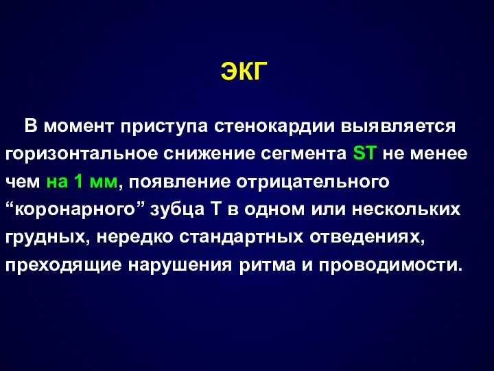 ЭКГ В момент приступа стенокардии выявляется горизонтальное снижение сегмента SТ не