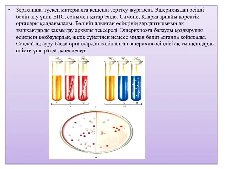 Зертханада түскен материалға кешенді зерттеу жүргізеді. Эшерихиядан өсінді бөліп алу үшін