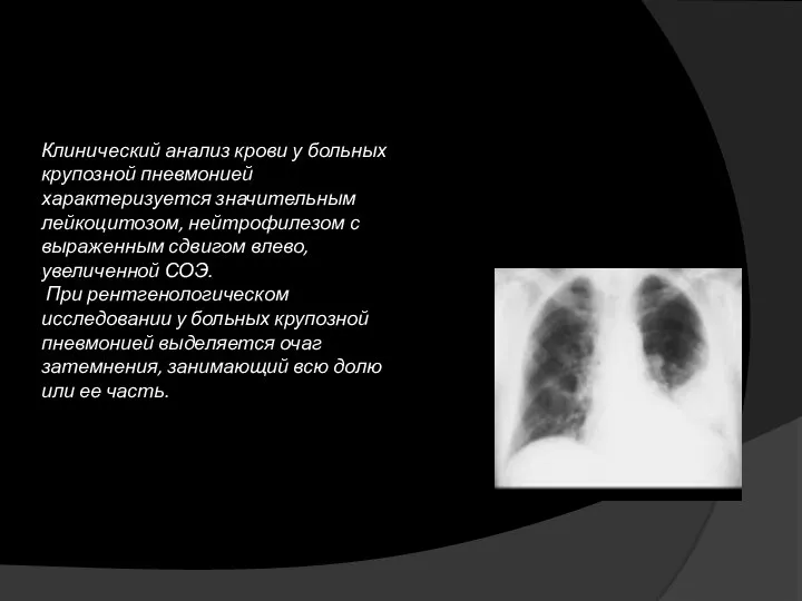 Клинический анализ крови у больных крупозной пневмонией характеризуется значительным лейкоцитозом, нейтрофилезом