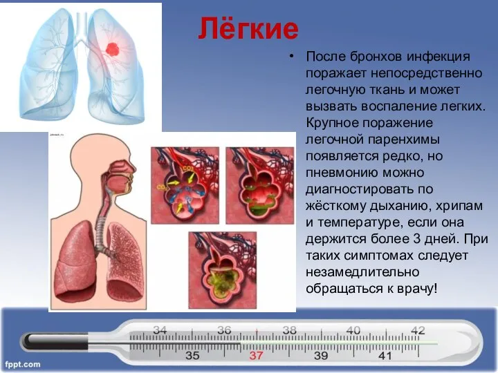 Лёгкие После бронхов инфекция поражает непосредственно легочную ткань и может вызвать