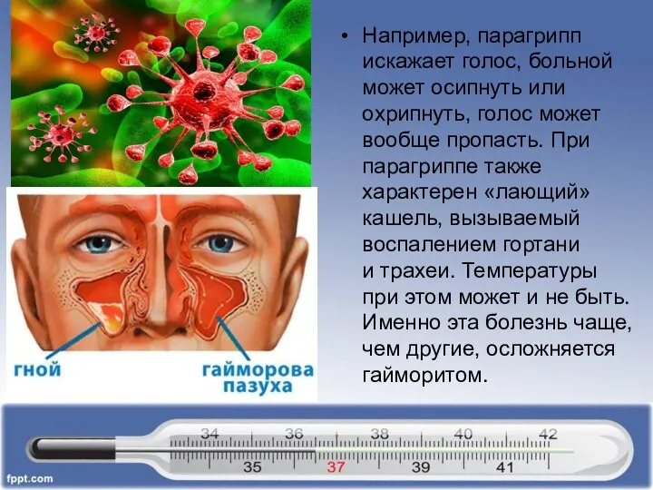 Например, парагрипп искажает голос, больной может осипнуть или охрипнуть, голос может