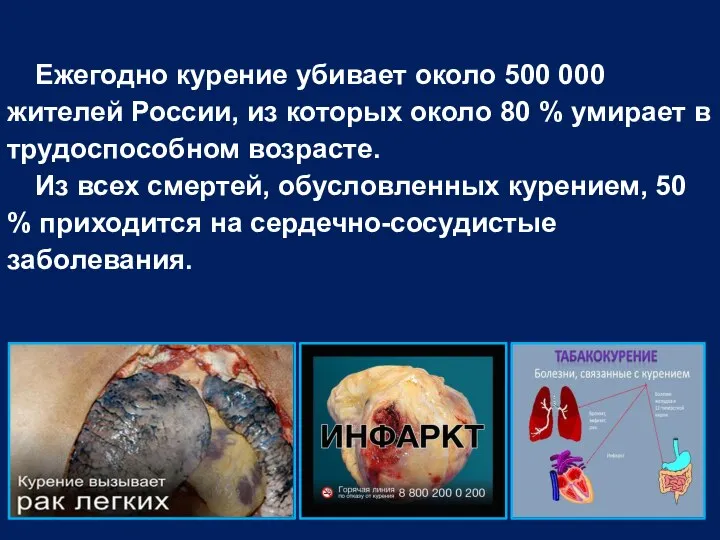 Ежегодно курение убивает около 500 000 жителей России, из которых около