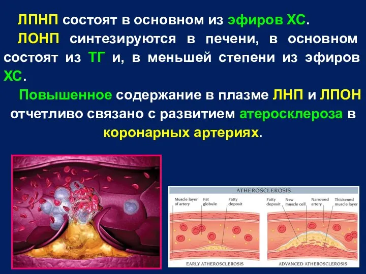 ЛПНП состоят в основном из эфиров ХС. ЛОНП синтезируются в печени,