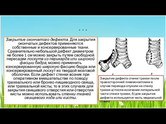 … Закрытие окончатого дефекта. Для закрытия окончатых дефектов применяются собственные и