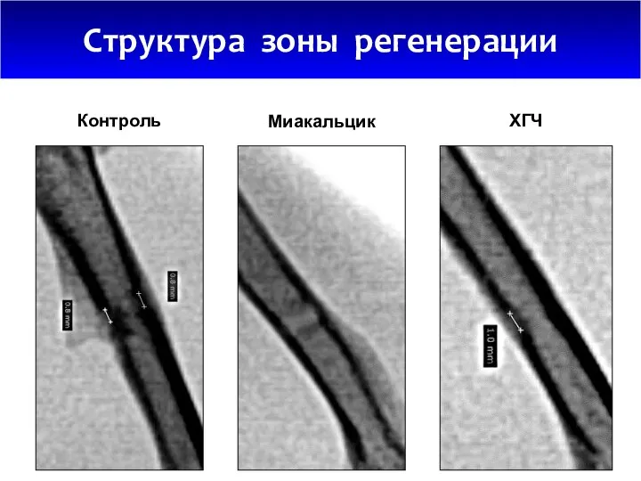 Структура зоны регенерации 0,86 ± 0,13 0,77 ± 0,16 Контроль Миакальцик ХГЧ