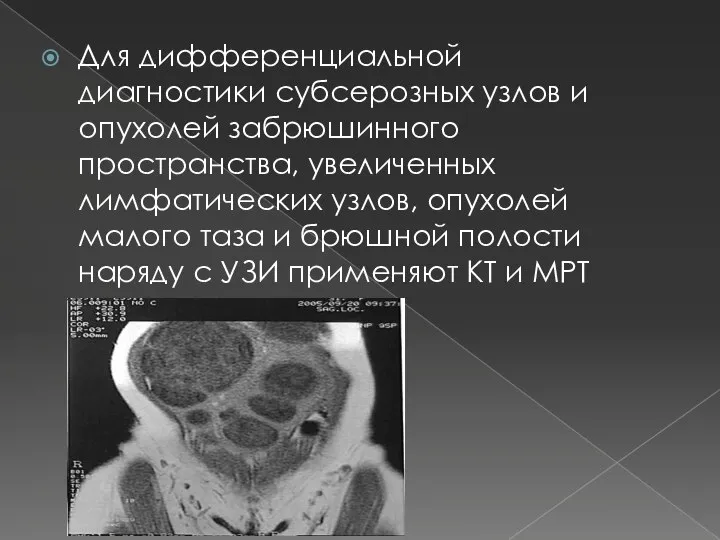 Для дифференциальной диагностики субсерозных узлов и опухолей забрюшинного пространства, увеличенных лимфатических