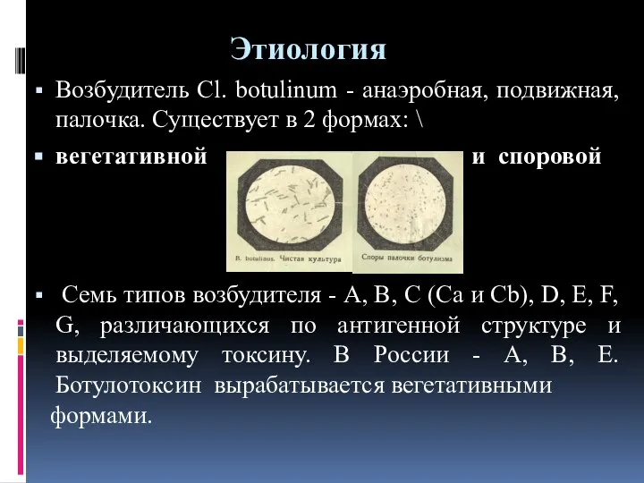 Этиология Возбудитель Cl. botulinum - анаэробная, подвижная, палочка. Существует в 2