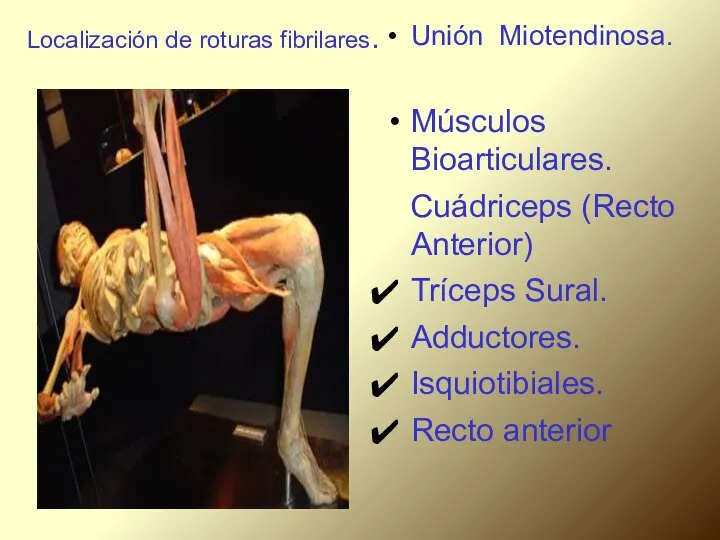 Localización de roturas fibrilares. Unión Miotendinosa. Músculos Bioarticulares. Cuádriceps (Recto Anterior)