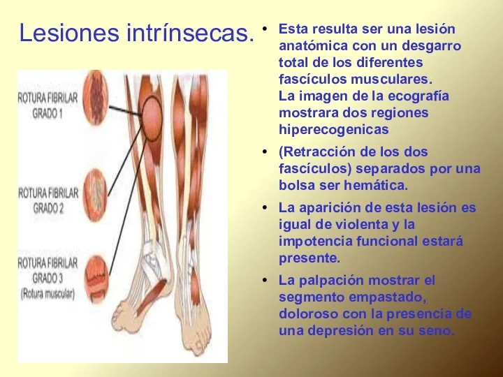 Lesiones intrínsecas. Esta resulta ser una lesión anatómica con un desgarro