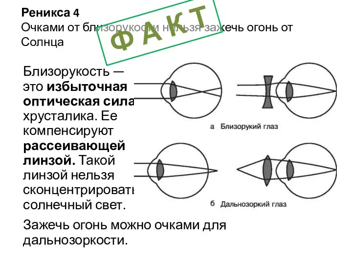 Реникса 4 Очками от близорукости нельзя зажечь огонь от Солнца Близорукость