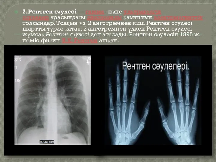 2.Рентген сәулесі — гамма- және ультракүлгін сәулелер арасындағы диапазонды қамтитын электрмагниттік