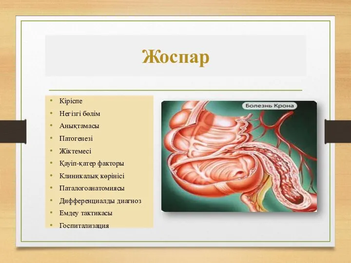 Жоспар Кіріспе Негізгі бөлім Анықтамасы Патогенезі Жіктемесі Қауіп-қатер факторы Клиникалық көрінісі