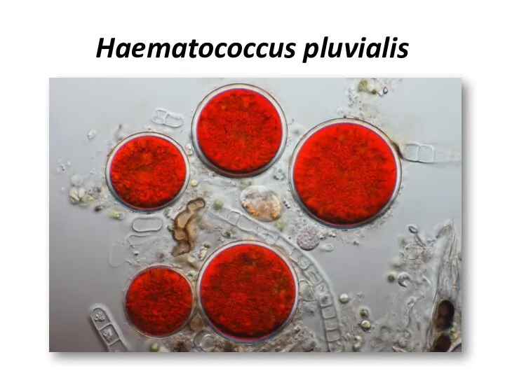 Haematococcus pluvialis