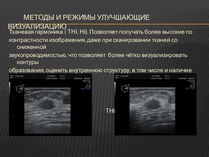 МЕТОДЫ И РЕЖИМЫ УЛУЧШАЮЩИЕ ВИЗУАЛИЗАЦИЮ Тканевая гармоника ( THI, HI). Позволяет