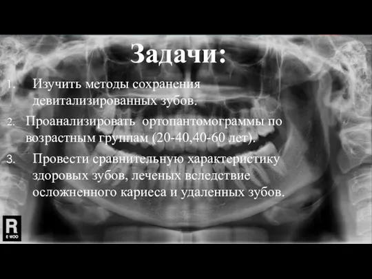 Задачи: Изучить методы сохранения девитализированных зубов. Проанализировать ортопантомограммы по возрастным группам