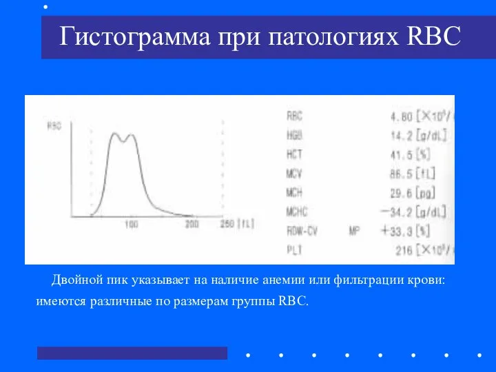 Гистограмма при патологиях RBC Двойной пик указывает на наличие анемии или