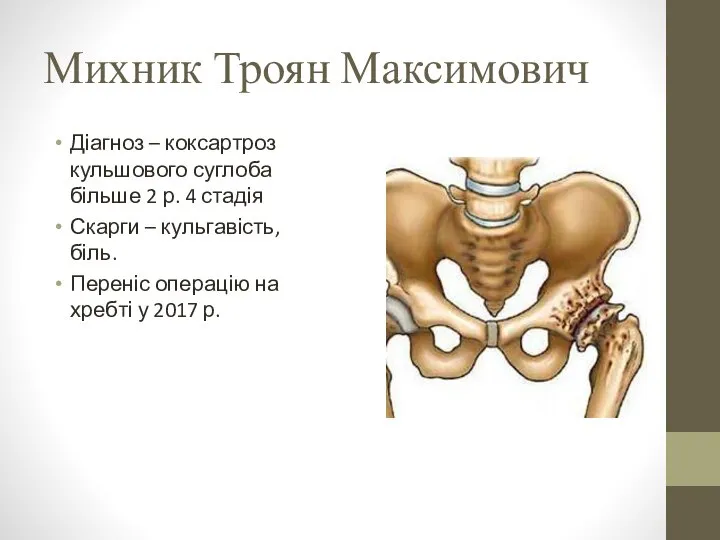 Михник Троян Максимович Діагноз – коксартроз кульшового суглоба більше 2 р.