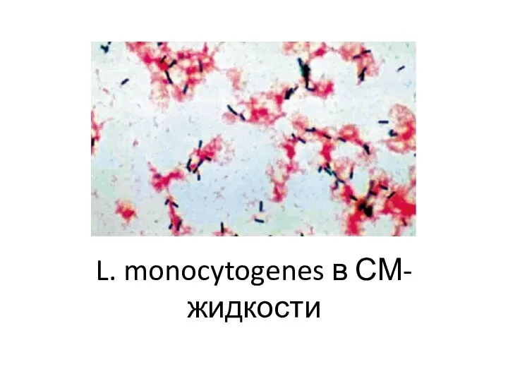 L. monocytogenes в СМ-жидкости