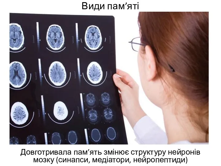 Види пам’яті Довготривала пам’ять змінює структуру нейронів мозку (синапси, медіатори, нейропептиди)